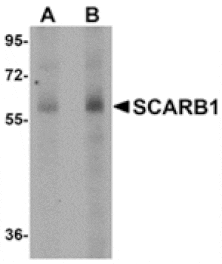 Western blot - SCARB1 Antibody from Signalway Antibody (24903) - Antibodies.com