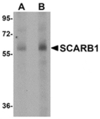 Western blot - SCARB1 Antibody from Signalway Antibody (24903) - Antibodies.com