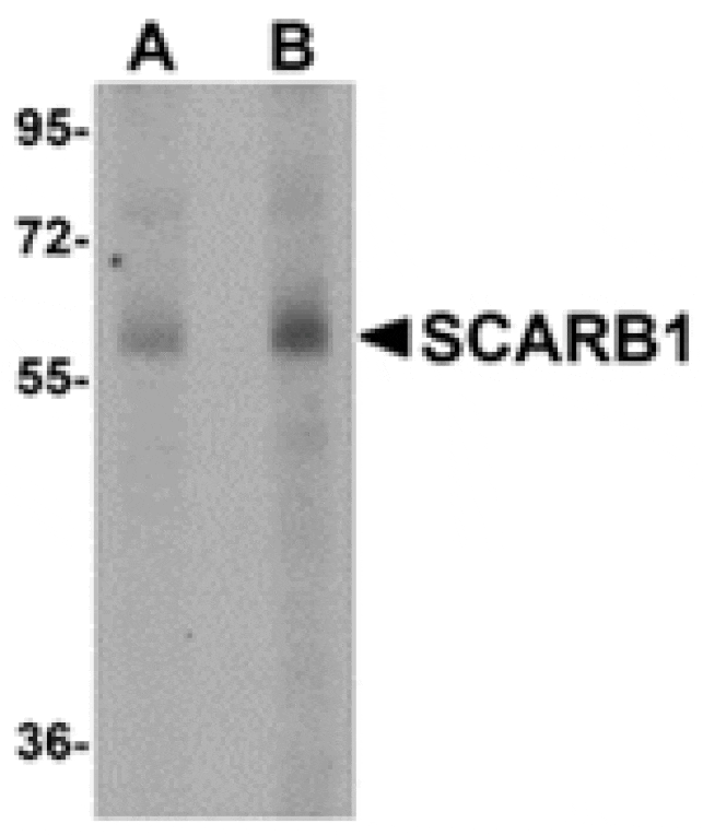Western blot - SCARB1 Antibody from Signalway Antibody (24903) - Antibodies.com
