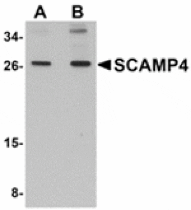 Western blot - SCAMP4 Antibody from Signalway Antibody (24942) - Antibodies.com