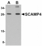 Western blot - SCAMP4 Antibody from Signalway Antibody (24942) - Antibodies.com