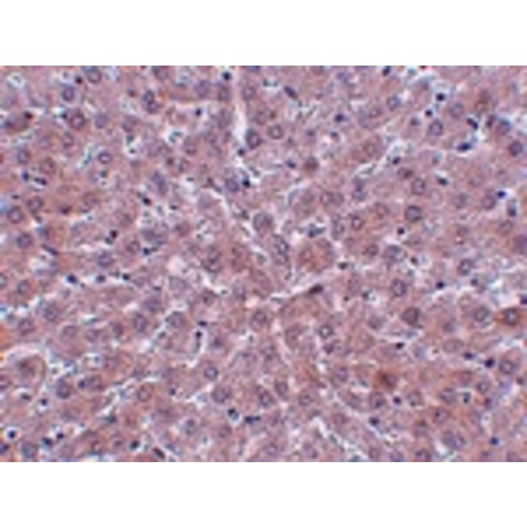 Immunohistochemistry - JMJD1B Antibody from Signalway Antibody (24956) - Antibodies.com