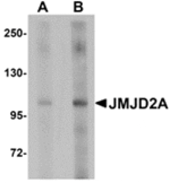 Western blot - JMJD2A Antibody from Signalway Antibody (24958) - Antibodies.com
