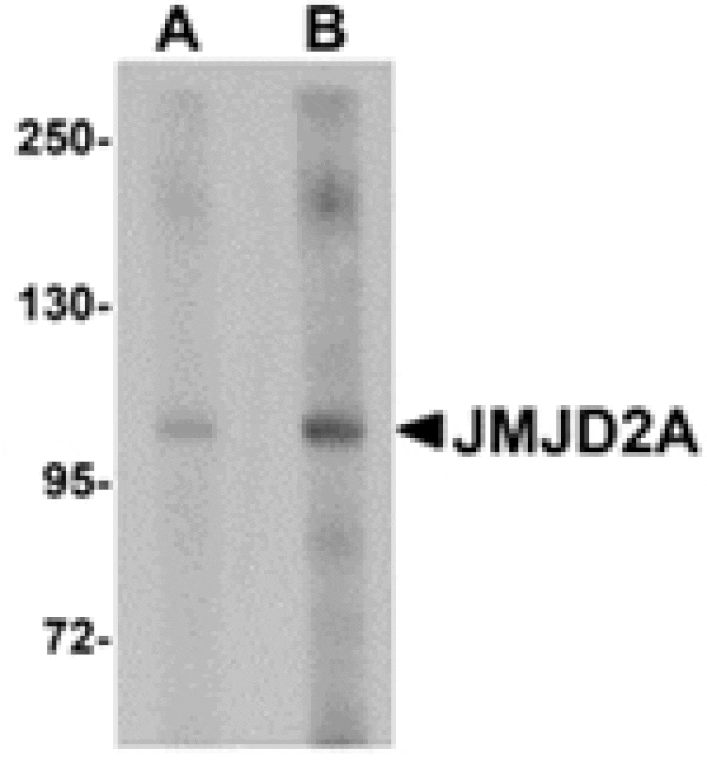 Western blot - JMJD2A Antibody from Signalway Antibody (24958) - Antibodies.com