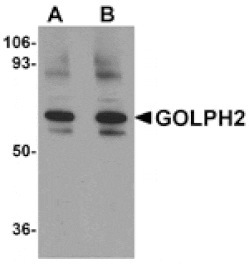 Western blot - GOLPH2 Antibody from Signalway Antibody (24985) - Antibodies.com