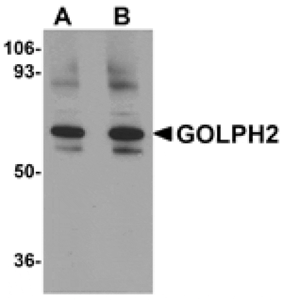 Western blot - GOLPH2 Antibody from Signalway Antibody (24985) - Antibodies.com
