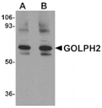 Western blot - GOLPH2 Antibody from Signalway Antibody (24985) - Antibodies.com