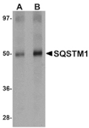 Western blot - SQSTM1 Antibody from Signalway Antibody (24989) - Antibodies.com