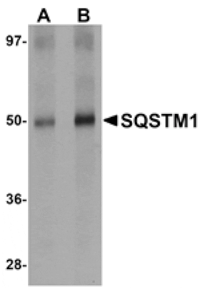 Western blot - SQSTM1 Antibody from Signalway Antibody (24989) - Antibodies.com