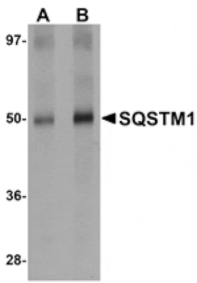 Western blot - SQSTM1 Antibody from Signalway Antibody (24989) - Antibodies.com