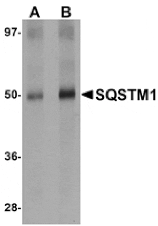 Western blot - SQSTM1 Antibody from Signalway Antibody (24989) - Antibodies.com