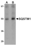 Western blot - SQSTM1 Antibody from Signalway Antibody (24989) - Antibodies.com