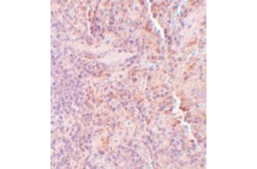 Immunohistochemistry - SQSTM1 Antibody from Signalway Antibody (24989) - Antibodies.com