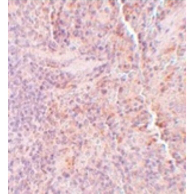 Immunohistochemistry - SQSTM1 Antibody from Signalway Antibody (24989) - Antibodies.com