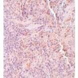 Immunohistochemistry - SQSTM1 Antibody from Signalway Antibody (24989) - Antibodies.com