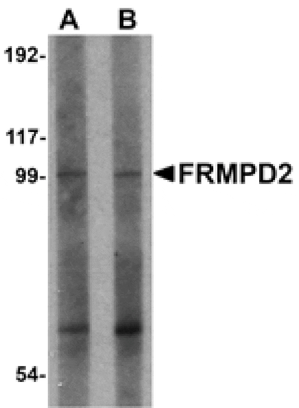 Western blot - FRMPD2 Antibody from Signalway Antibody (24992) - Antibodies.com