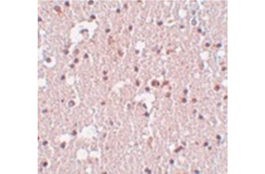 Immunohistochemistry - FRMPD3 Antibody from Signalway Antibody (24993) - Antibodies.com