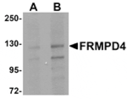 Western blot - FRMPD4 Antibody from Signalway Antibody (24994) - Antibodies.com