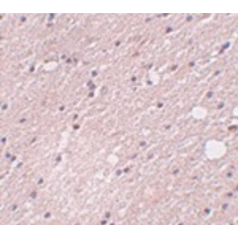 Immunohistochemistry - FRMPD4 Antibody from Signalway Antibody (24994) - Antibodies.com