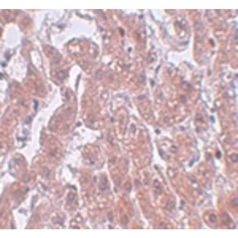Immunohistochemistry - FAM59A Antibody from Signalway Antibody (25001) - Antibodies.com