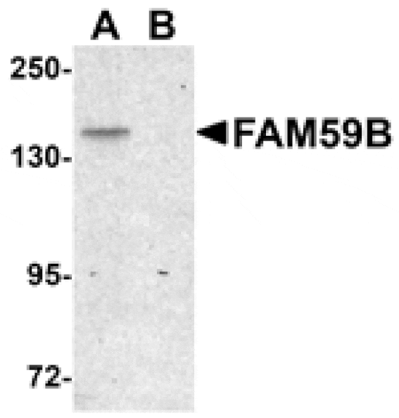 Western blot - FAM59B Antibody from Signalway Antibody (25002) - Antibodies.com