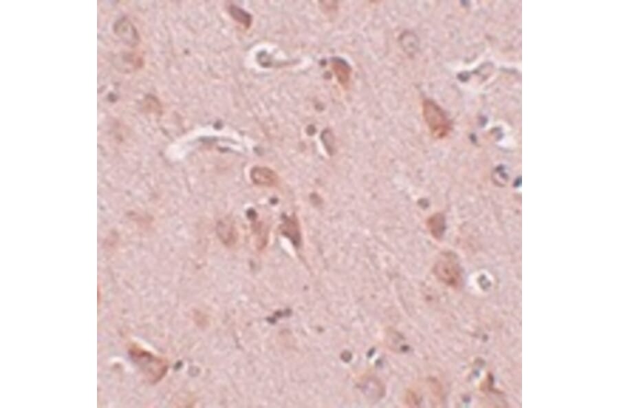 Immunohistochemistry - FAM59B Antibody from Signalway Antibody (25002) - Antibodies.com