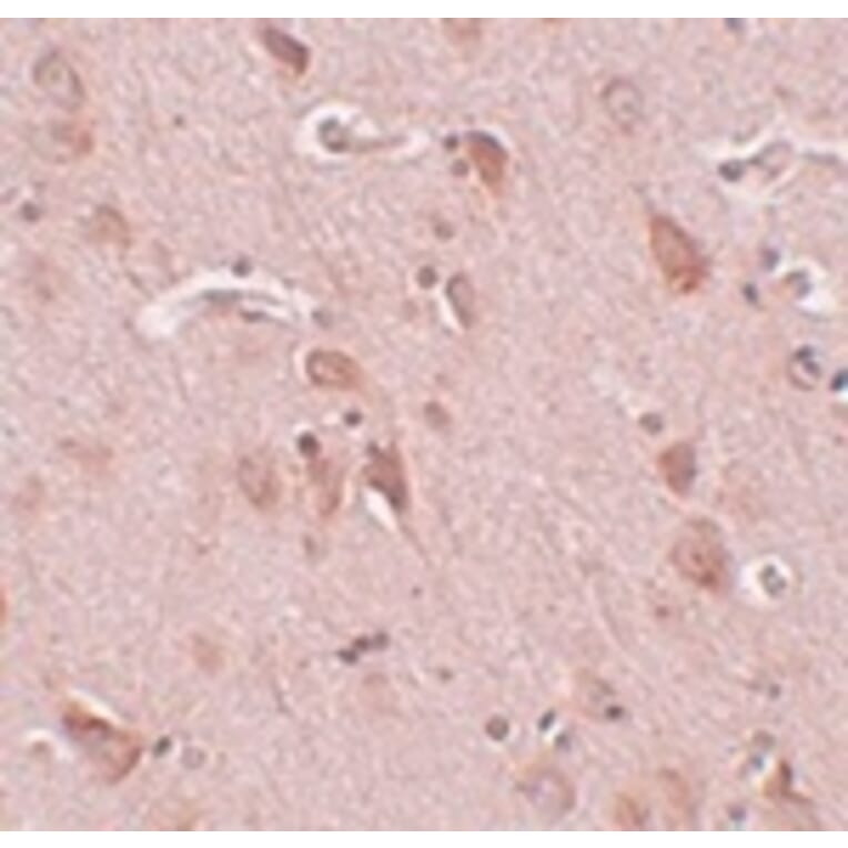 Immunohistochemistry - FAM59B Antibody from Signalway Antibody (25002) - Antibodies.com