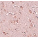 Immunohistochemistry - FAM59B Antibody from Signalway Antibody (25002) - Antibodies.com