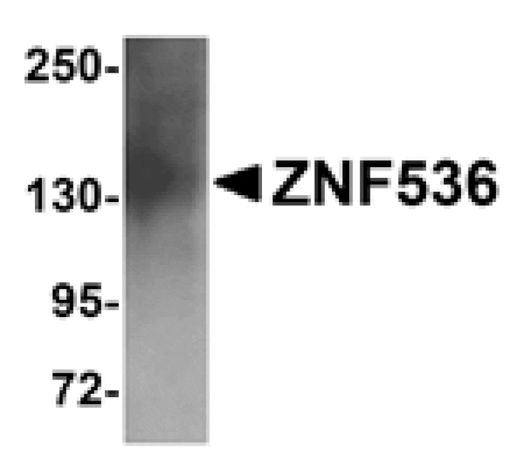 Western blot - ZNF536 Antibody from Signalway Antibody (25011) - Antibodies.com