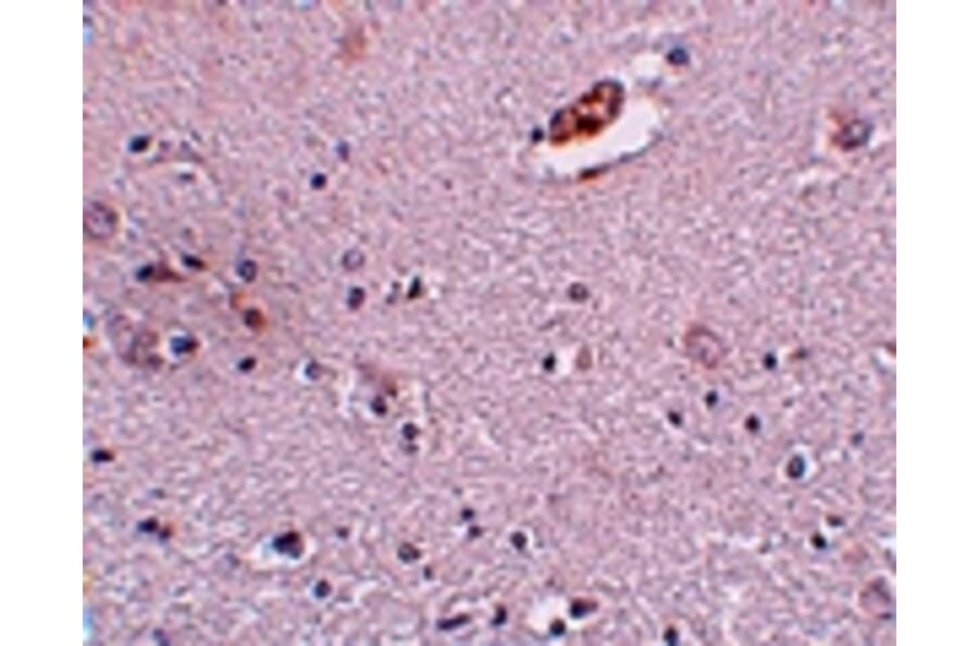 Immunohistochemistry - ZNF536 Antibody from Signalway Antibody (25011) - Antibodies.com