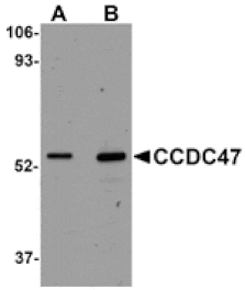 Western blot - CCDC47 Antibody from Signalway Antibody (25012) - Antibodies.com