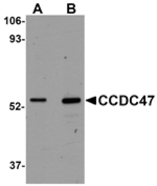 Western blot - CCDC47 Antibody from Signalway Antibody (25012) - Antibodies.com