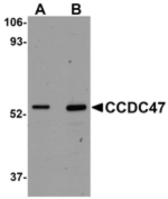 Western blot - CCDC47 Antibody from Signalway Antibody (25012) - Antibodies.com