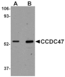 Western blot - CCDC47 Antibody from Signalway Antibody (25012) - Antibodies.com
