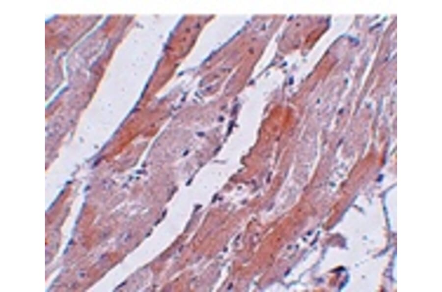 Immunohistochemistry - CCDC47 Antibody from Signalway Antibody (25012) - Antibodies.com