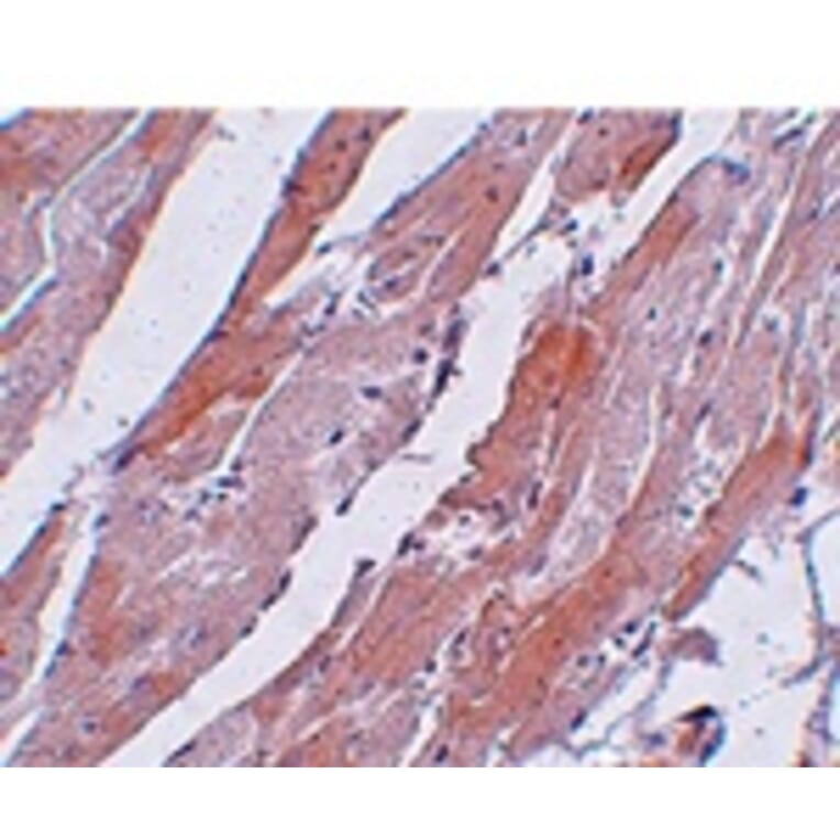 Immunohistochemistry - CCDC47 Antibody from Signalway Antibody (25012) - Antibodies.com