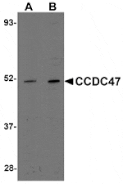 Western blot - CCDC47 Antibody from Signalway Antibody (25013) - Antibodies.com