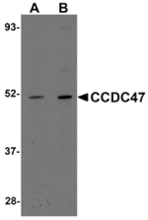 Western blot - CCDC47 Antibody from Signalway Antibody (25013) - Antibodies.com