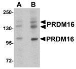 Western blot analysis of PRDM16 in rat brain tissue lysate with PRDM16 antibody at (A) 1 and (B) 2 µg/mL.