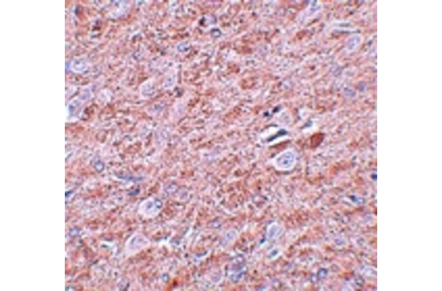 Immunohistochemistry - PRDM16 Antibody from Signalway Antibody (25030) - Antibodies.com