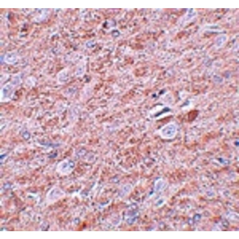 Immunohistochemistry - PRDM16 Antibody from Signalway Antibody (25030) - Antibodies.com