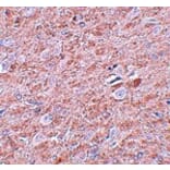 Immunohistochemistry - PRDM16 Antibody from Signalway Antibody (25030) - Antibodies.com
