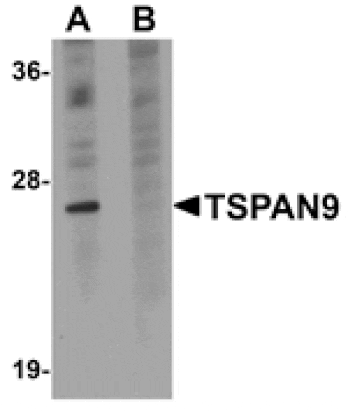 Western blot - TSPAN9 Antibody from Signalway Antibody (25032) - Antibodies.com