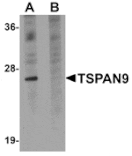 Western blot - TSPAN9 Antibody from Signalway Antibody (25032) - Antibodies.com