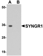 Western blot analysis of SYNGR1 in rat brain tissue lysate with SYNGR1 antibody at 1 µg/mL in (A) the absence and (B) the presence of blocking peptide.