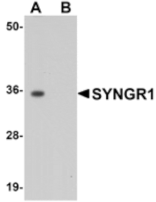 Western blot - SYNGR1 Antibody from Signalway Antibody (25034) - Antibodies.com