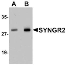 Western blot - SYNGR2 Antibody from Signalway Antibody (25035) - Antibodies.com