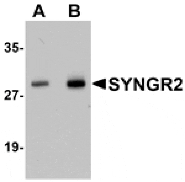 Western blot - SYNGR2 Antibody from Signalway Antibody (25035) - Antibodies.com