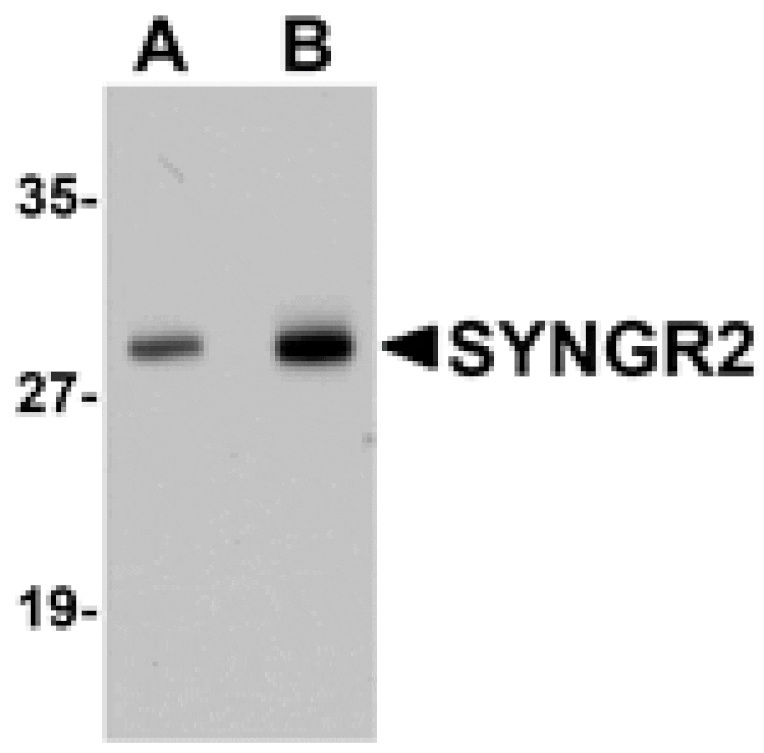 Western blot - SYNGR2 Antibody from Signalway Antibody (25035) - Antibodies.com
