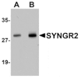 Western blot - SYNGR2 Antibody from Signalway Antibody (25035) - Antibodies.com